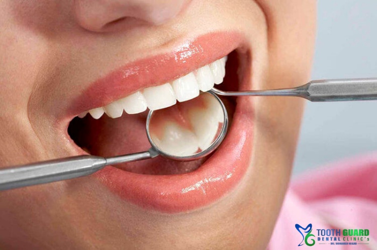 Infected tooth nerve treatment